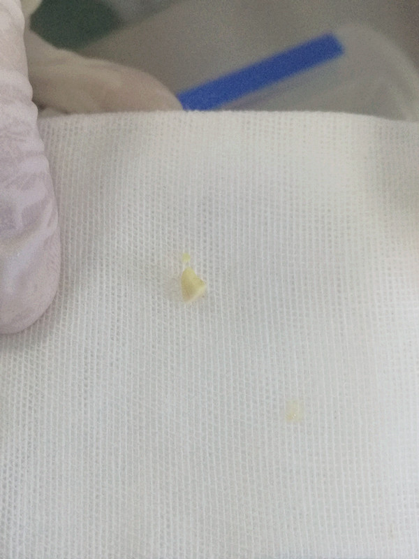 九个月咳嗽吐奶 1517966911621086895.jpg