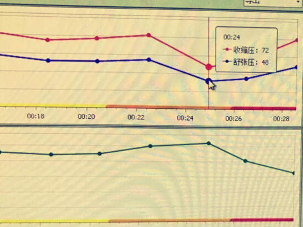 1520841245605085411.jpg 血压 (1).jpg