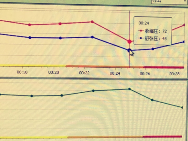 血压 (1).jpg