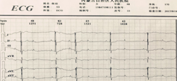 心电图2.jpg