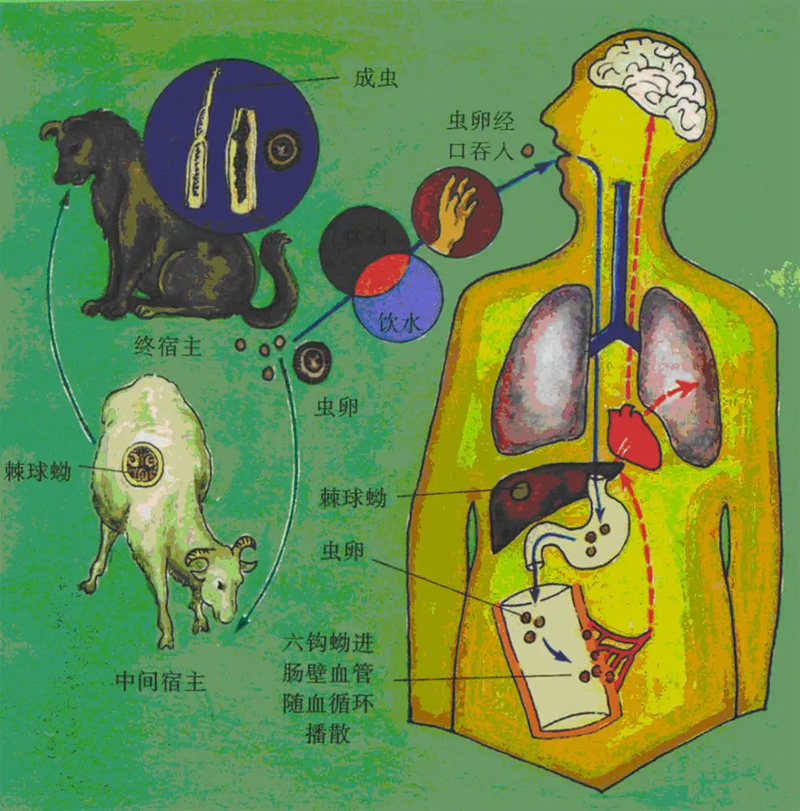 图01肝包虫发病机制.png
